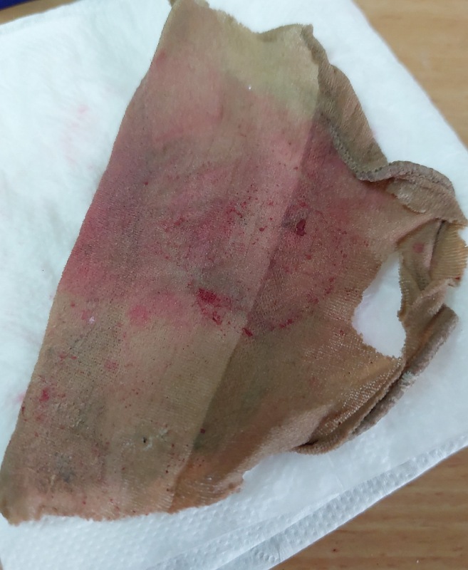 Größere Teile nach leichtem Auswaschen